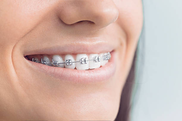 Best Full Mouth Reconstruction  in Russell Springs, KY
